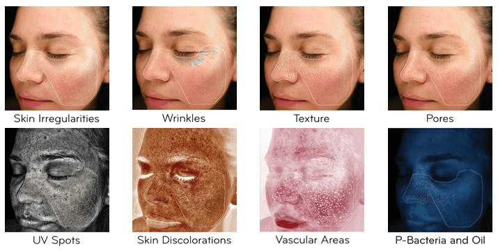 Skin care Analysis